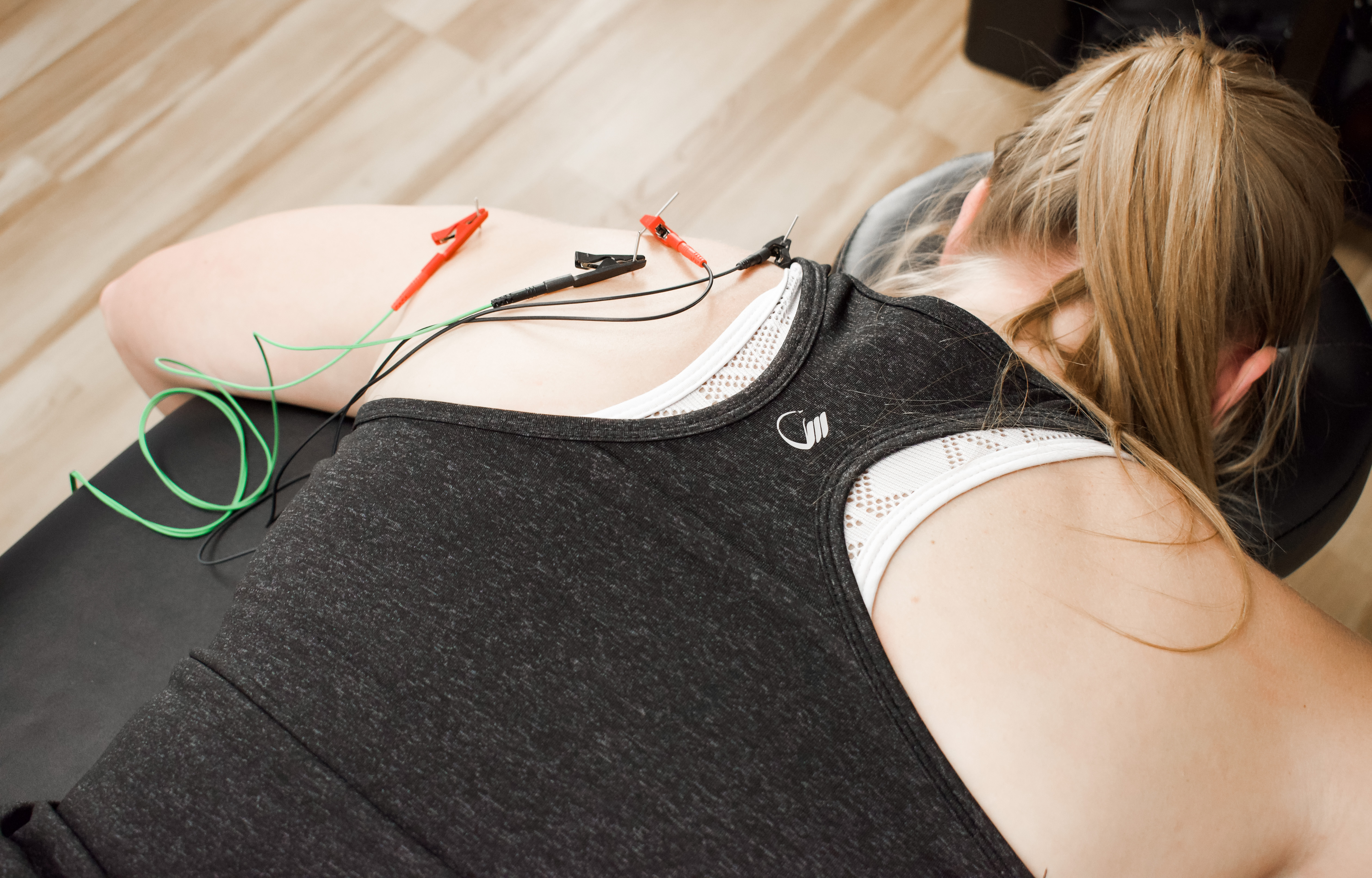 Dry Needling Physical Therapy
